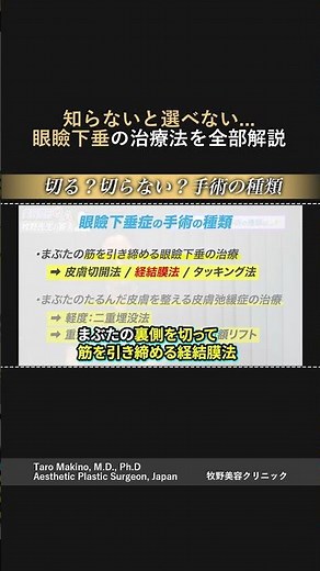 【知らないと選べない】眼瞼下垂の治療法、全部説明します