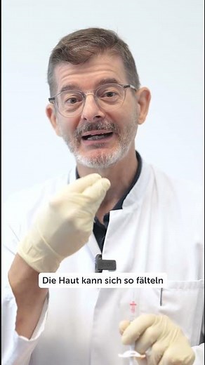 PLISSEEFALTEN UM DEN MUND #düsseldorf #raucherfalten #botox #plastischechirurgie #behandlung #mund