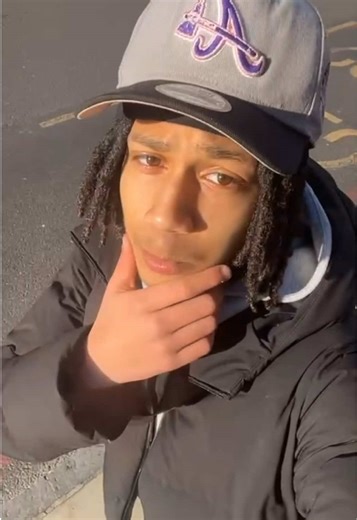 #fyp #lightskin #fyppp #summer #burger 1k likes word to bro ill cut my locs off