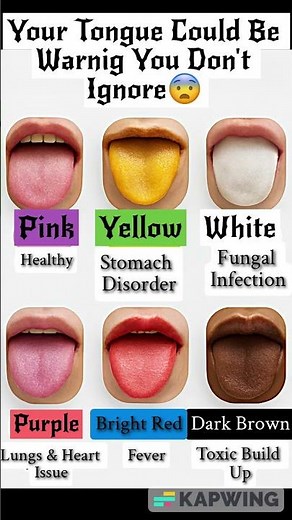 6 Tongue Colors That Reveal Health Warnings 👅😨