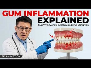 Gum Inflammation Explained – Gingivitis Causes, Symptoms & Prevention Tips