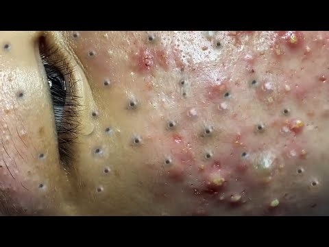 𝑺𝒐𝒐𝒕𝒉𝒊𝒏𝒈 𝑭𝒂𝒄𝒊𝒂𝒍 𝑻𝒓𝒆𝒂𝒕𝒎𝒆𝒏𝒕 𝒇𝒐𝒓 𝑺𝒕𝒓𝒆𝒔𝒔 𝑹𝒆𝒍𝒊𝒆𝒇 | 𝑫𝒆𝒆𝒑 𝑪𝒍𝒆𝒂𝒏𝒊𝒏𝒈 & 𝑪𝒂𝒍𝒎𝒊𝒏𝒈 𝑴𝒂𝒔𝒔𝒂𝒈𝒆 𝒂𝒕 𝑳𝒖𝒙𝒖𝒓𝒚 𝑺𝒑𝒂 #𝟔𝟔𝟎𝟐𝟏𝟔𝟓