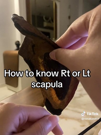Identifying Right or Left Scapula: A Guide for Medical Students