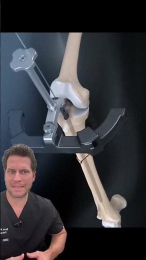 Tibial Shaft Fracture Repair- Dr. Porter