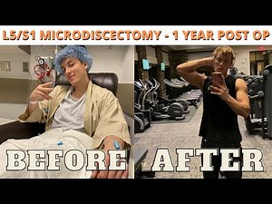 L5/S1 Microdiscectomy: 1 year post op