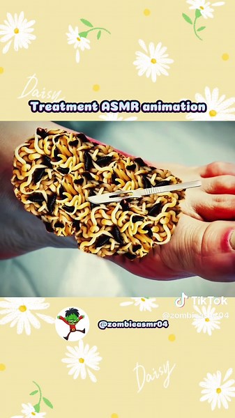 Treatment foots ASMR - Part 2 #asmr #asmrvideos #asmrtiktok #relaxing #satisfyingsounds