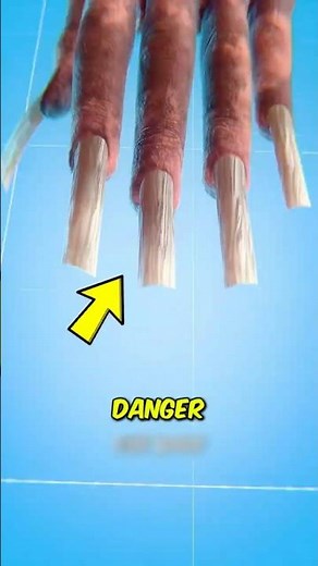 What Really Happens When You Bite Your Nails 😬#shorts
