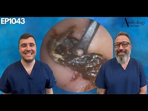 OPERA SINGERS STICKY EAR WAX REMOVAL - EP1042