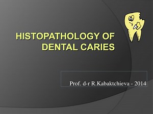 PPT - Histopathology of Dental Caries PowerPoint Presentation, free download - ID:2053621