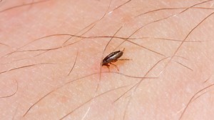 How to Get Rid of Flea Bite Marks