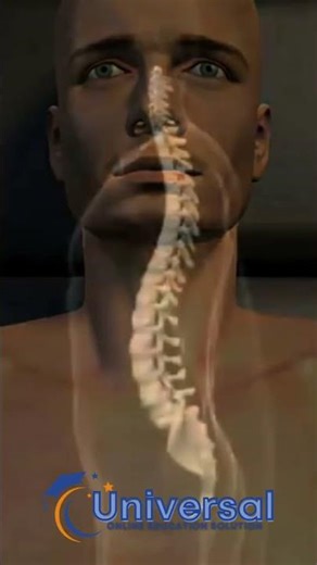 Cervical Total Disc Replacement Explained in 60 Seconds | Spine Surgery Made Simple