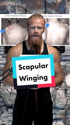 Understanding Scapular Winging: Diagnosis and Exercises