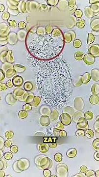 Surprising Facts About White Blood Cells That Can Be "Visible" When Looking at the Blue Sky #Whit...