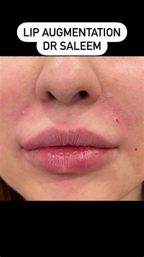 Doctor Saleem plastic surgeon on TikTok