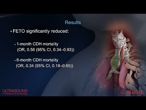Fetal endoscopic tracheal occlusion on clinical outcomes of congenital diaphragmatic hernia