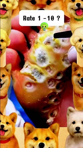 Extreme Foot Blackhead Removal – You Won’t Believe This! 😱 #short #footcare #pimple