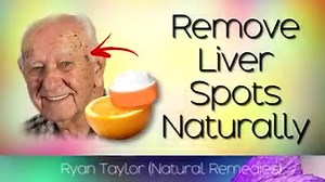 In today's video we will highlight how to remove liver spots naturally using natural remedies. These are very simple and cheap ways to get rid of age spots, pigmentation and liver spots from your skin. We also explain why Vitamin C is one of the key nutrients to help protect the skin from sun damage and prevent further formation of these dark patches of skin. | Ryan Taylor Natural Remedies
