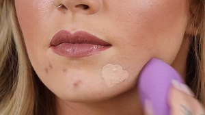 1.9K reactions · 82 shares | Bye bye blemishes! Watch as Lex...