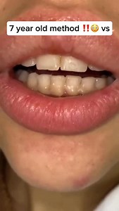 4.2M views · 37K reactions | How to Use the Miswak Peel about 1 cm (½...