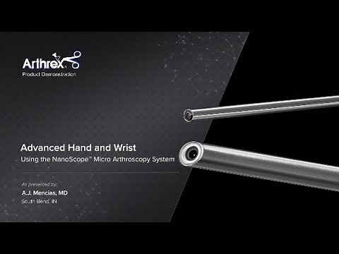 Advanced Hand and Wrist Using the NanoScope™ Micro Arthroscopy System