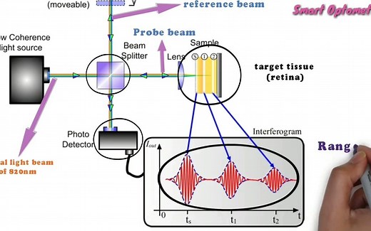 【光学相干断层扫描】Optical Coherence Tomography - OCT (Full)
