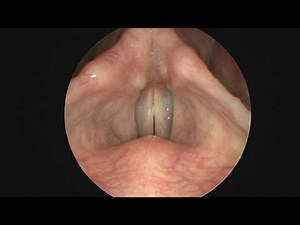 Ενδοσκόπηση λάρυγγα - Η φυσιολογική λειτουργία λάρυγγα