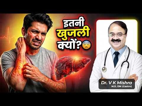 Jaundice में Itching क्यों होती है? 😨 Liver Problem Sign | Full Explanation (Hindi) Live