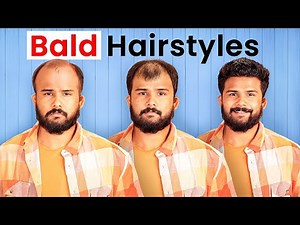 Balding at 22? Try these Hairstyles ( Not Sponsored )