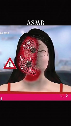 How to Safely Remove Spider and Worm Eggs from the Skin