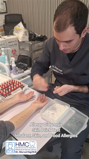 Allergy Diagnosis Allergy Skin Prick Test Inhalant, Skin, and Food Allergy #lebanon #لبنان #health #medicine #health #doctor #beirut #food #foodallergy #allergy