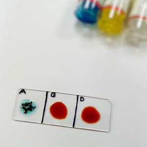 78K views · 2K reactions | 4 Surprising facts about your Blood Type | Doctor ASKY | Facebook