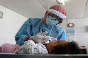 ¿Qué es la difteria y por qué es tan peligrosa en plena pandemia?: 8 datos que debes conocer