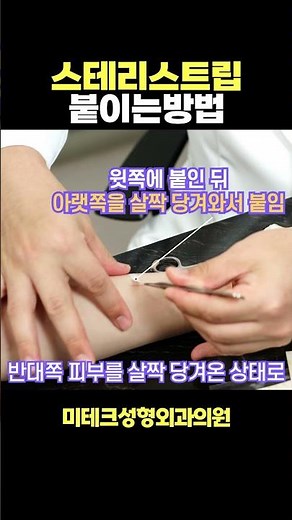 How to apply Steri-Strips!