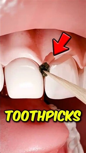 Why Toothpicks Are BAD for Your Teeth! 😱🦷
