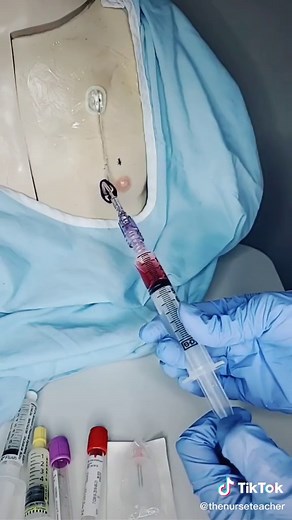 Drawing blood from a port using the syringe method #clinicals #nursing #clinicalskills #nursingskills #portacath #centrallines