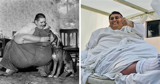 Remarkable Stories Of The Heaviest Recorded People In History