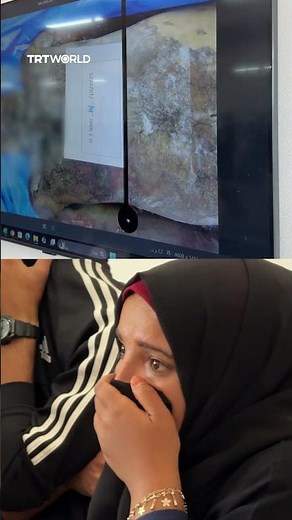 Palestinians struggle to identify tortured bodies returned by Israel