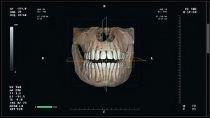 clip-3481999351-healthcare-examination-software-inspecting-3d-recreation-human