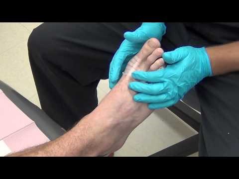 Steri Strip Application