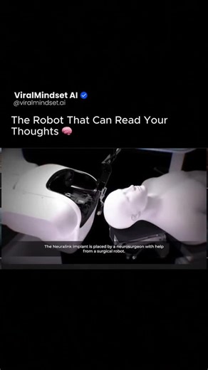 AI | Tech | Tools on Instagram: "Neuralink’s robot places each ultra-thin thread, thinner than a human hair, directly into the brain with extraordinary precision. It avoids blood vessels automatically, operates fully on its own, and performs the procedure so gently that it leaves almost no visible mark. And the result? People with paralysis can move cursors, play games, and communicate again… just by thinking. This is not sci-fi anymore. This is how thoughts control technology. #viralmindset #vi