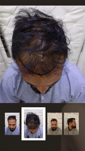 Real Results. Real Confidence. Only at Studio6 in Delhi NCR!