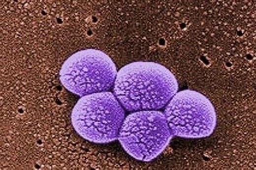 What is MRSA? Symptoms and how to avoid deadly infection after rise in UK cases