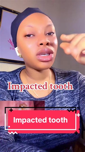 Wisdom Teeth Removal: Recovery Tips and Hacks