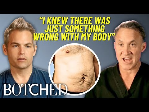 Eric Almost Died TWICE From Botched Gastric Bypass Surgery & Now Wants A Tummy Tuck | Botched | E!