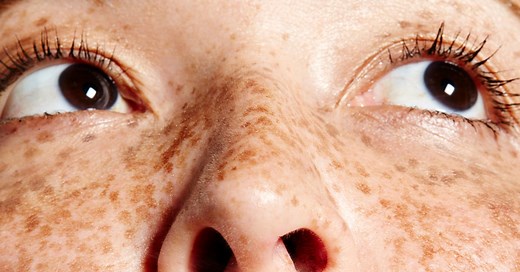 Freckles Are 'In' Now — And People Who Grew Up Hating Theirs Have Thoughts