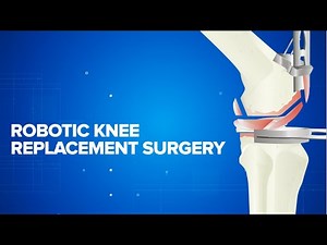 Robotic Knee Replacement Surgery