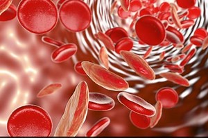 Blood clotting disorders, signs and symptoms | Emergency Live