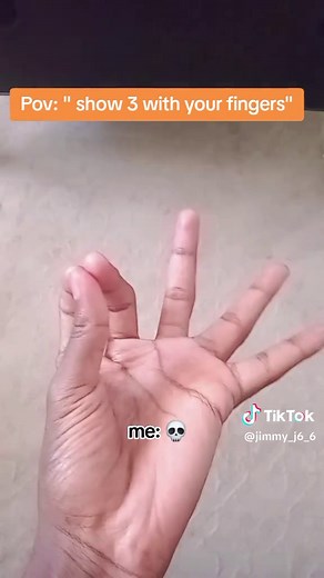 Understanding Unique Finger Anatomy: Six Fingers Explained