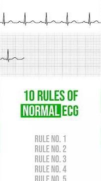 10 rules of Normal ECG (12 lead ECG interpretation) #ecg #cardiology #ecginterpretation