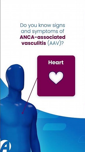 ANCA-associated #vasculitis can affect your major organs, skin, nerves and more.